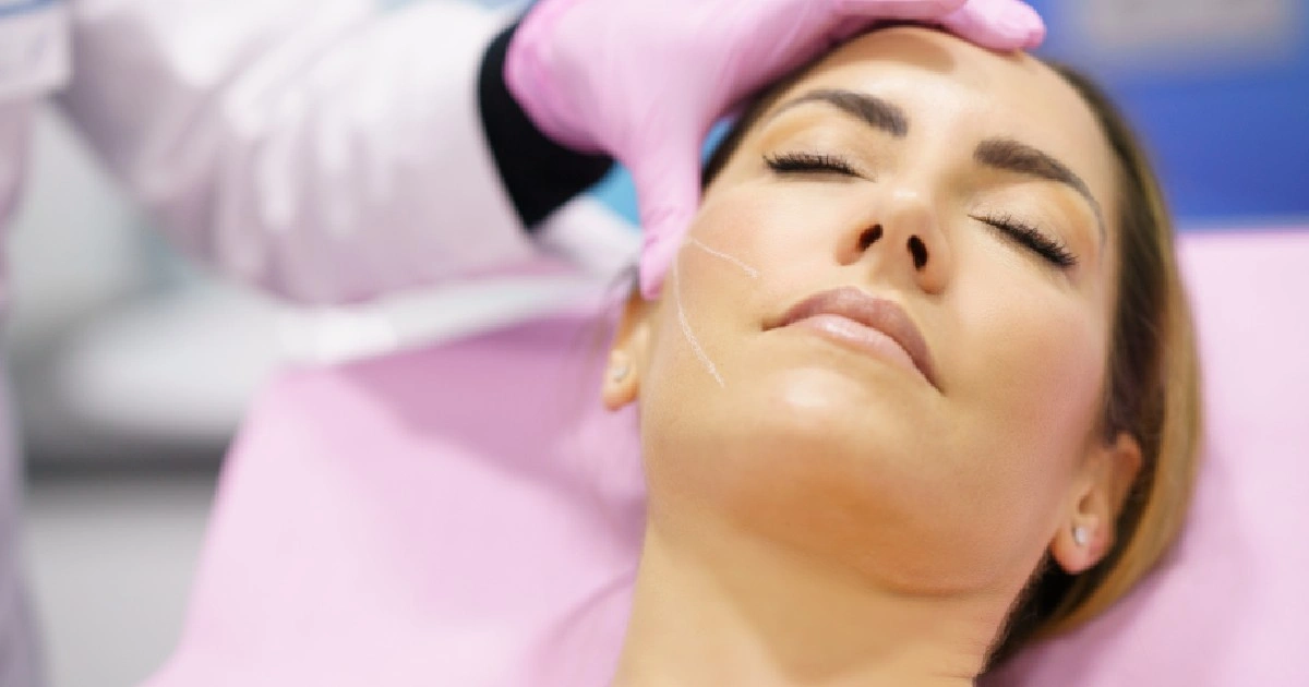 Women taking PDO Thread Lifts in tracy, ca