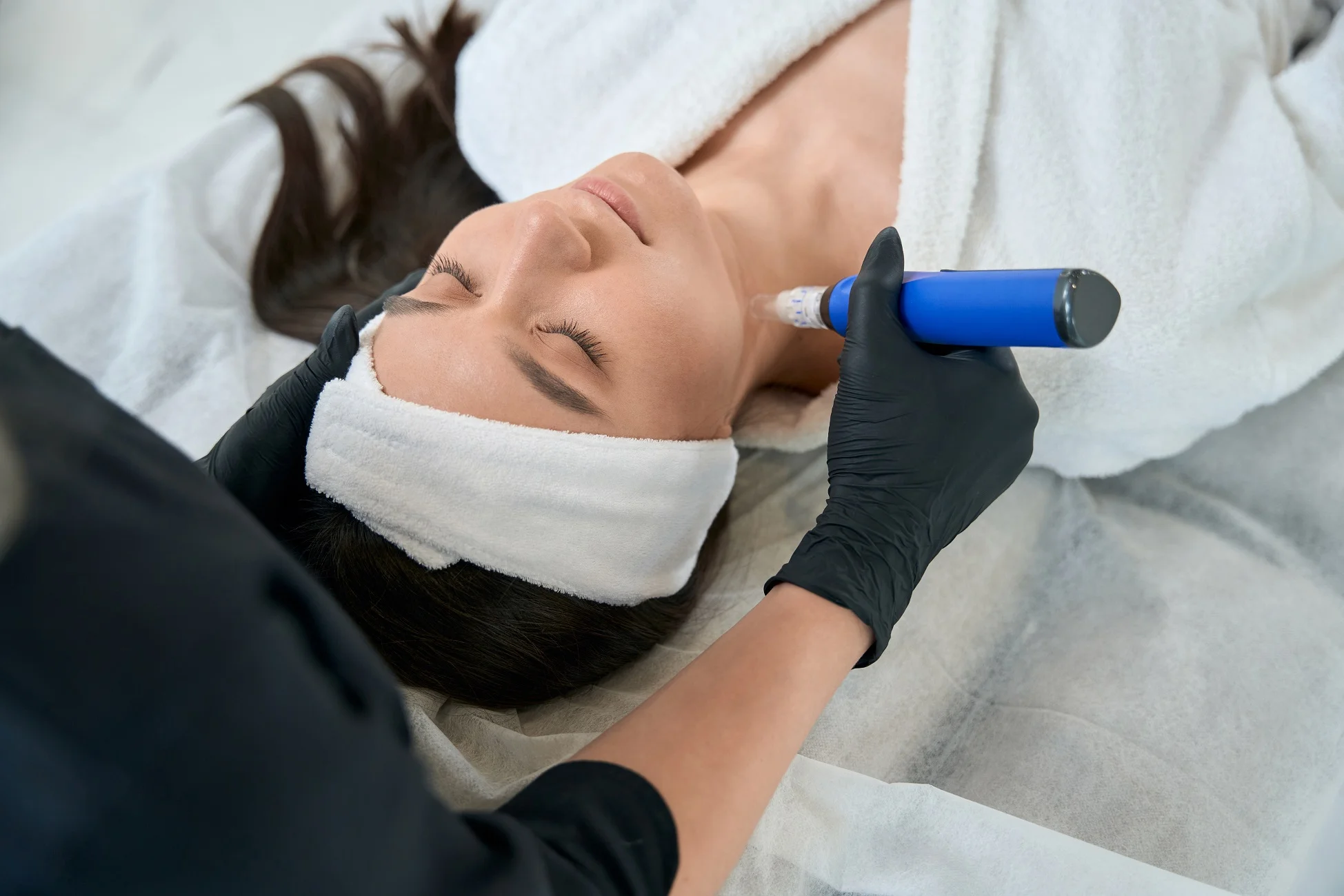Client enjoying professional Microneedling treatment in a spa setting in Tracy, CA | A Perfect Finnish Medical Spa