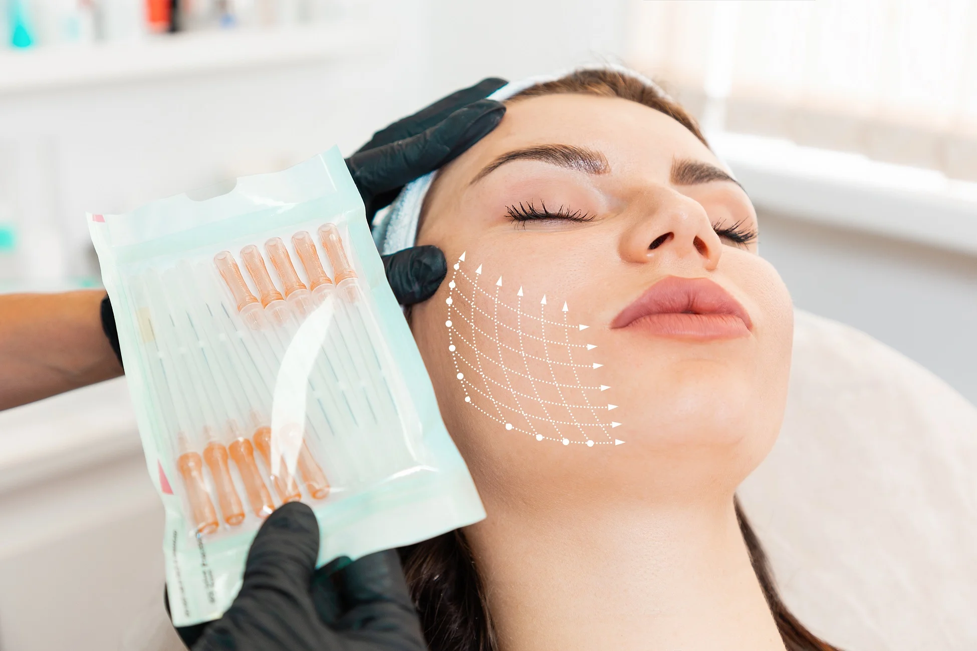 Woman Receiving PDO Thread Treatments in Tracy, CA | A Perfect Finnish Medical Spa